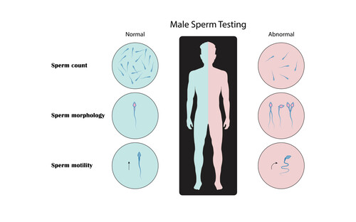 What Is Male Infertility And How Does It Impact Conception Complete